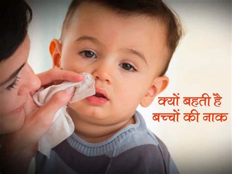 Home Remedies For Runny Nose In Babies बिना सर्दी जुकाम हुए इसलिए बहती