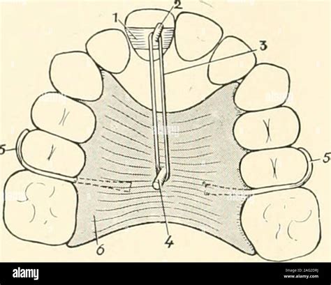 Labial Surgery Hi Res Stock Photography And Images Alamy