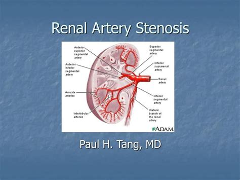 Ppt Renal Artery Stenosis Powerpoint Presentation Free Download Id766262