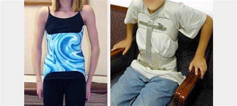 Juvenile Scoliosis - Best Non-Surgical Treatment Option