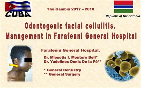 Odontogenic Facial Cellulitis Management Ppt