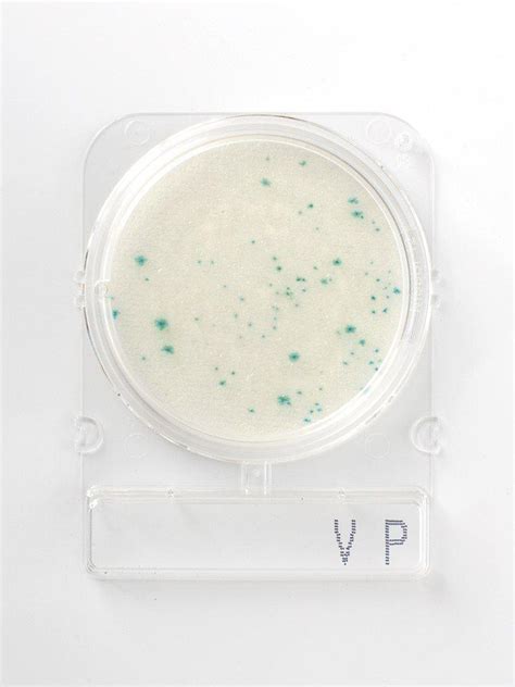 Compact Dry VP Food Diagnostics