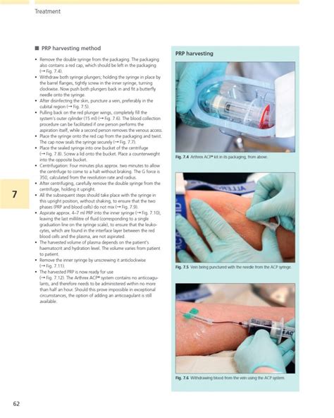 Illustrated Guide To Collagen Induction With Platelet Rich Plasma Prp