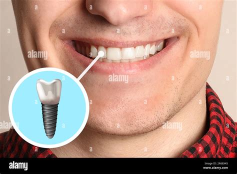 Happy Man With Perfect Teeth Smiling On Beige Background Closeup