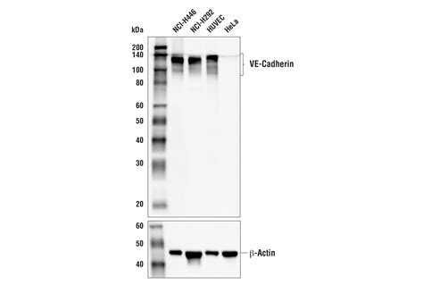 VE Cadherin E6N7A Rabbit MAb Cell Signaling Technology