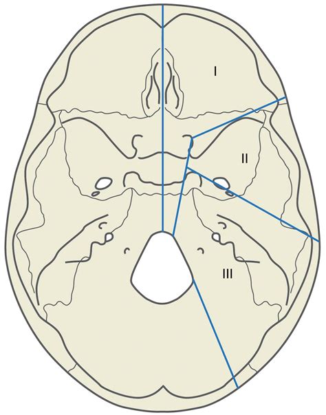 reconstruction   skull base clinical tree