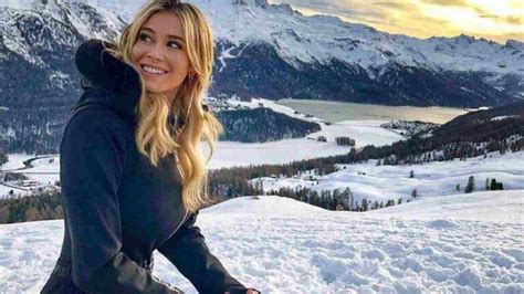 Diletta Leotta Rifatta Ecco La Foto Prima E Dopo La Chirurgia