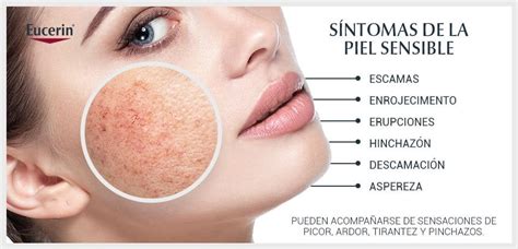 Piel Sensible Y Seca Causas Y Tips Para Cuidarla Eucerin®