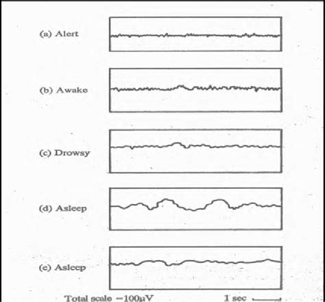 15 1 Typical Human Eeg Patterns During Different States Of Activity