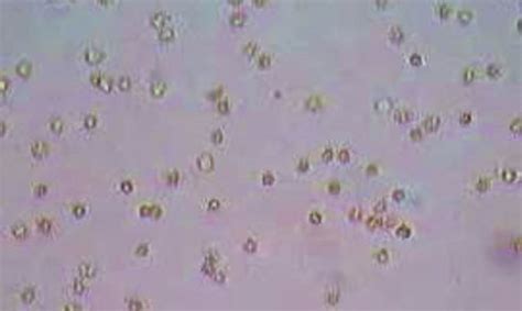 Red Blood Cells Microscope Hypertonic