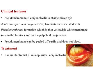 Conjunctivitis | PPT