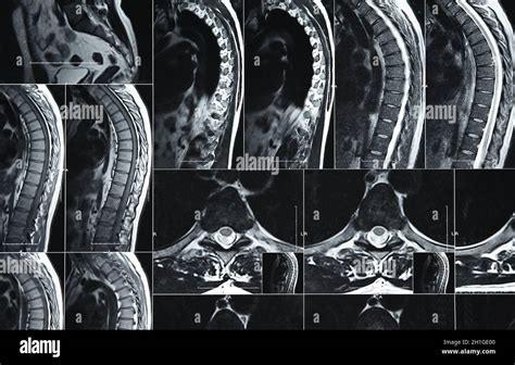 Close Up Magnetic Resonance Imaging Or Computed Tomography Scan Of