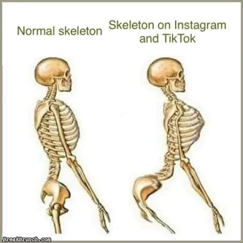 Skeleton On Instagram And Tiktok Breakbrunch