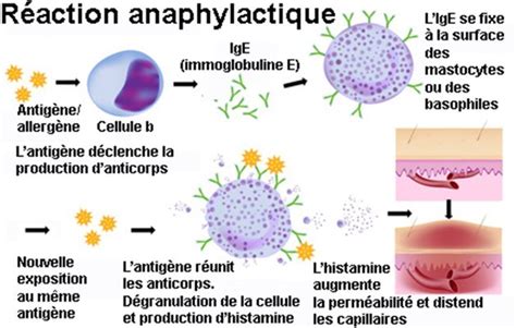 Choc Anaphylactique Sympt Mes Traitement D Finition Docteurclic