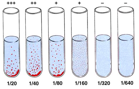 Salmonella Widal Test Indications Meaning Vinmec