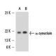 alpha Synuclein抗体 Syn 204 SCBT Santa Cruz Biotechnology