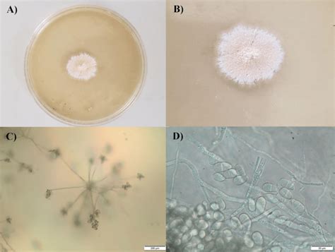 A And B Colony Morphology Of T Roseum On Pda Medium C Conidiophores