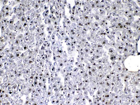 Anti Flt Vegfr Antibody Rabbit Anti Human Polyclonal Ihc Wb Lsbio