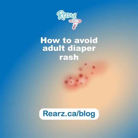 Tips For Preventing Adult Diaper Rashes Rearz Inc