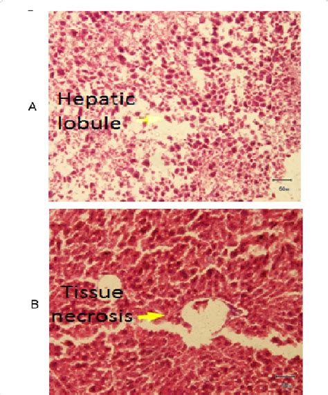 A Photomicrograph Of Liver Showing Normal Architecture Hande 200x Group