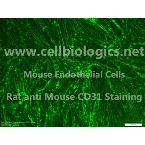 BALB C Mouse Primary Aortic Endothelial Cells