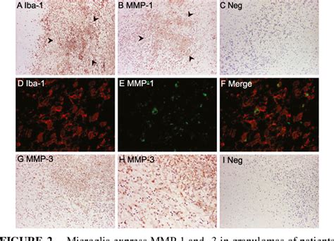 Figure 2 From Mycobacterium Tuberculosis Upregulates Microglial Matrix