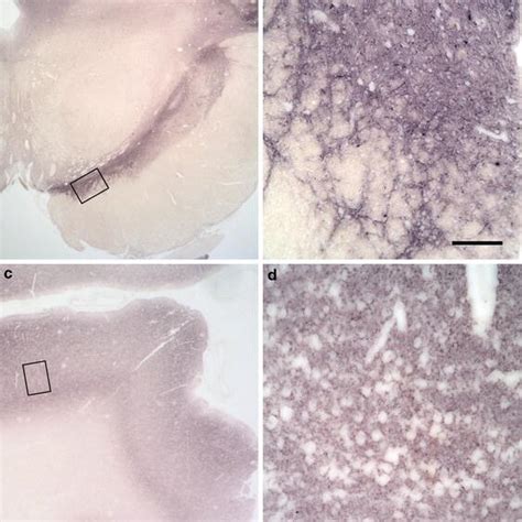 Synaptic α synuclein aggregates are the main synuclein pathology in