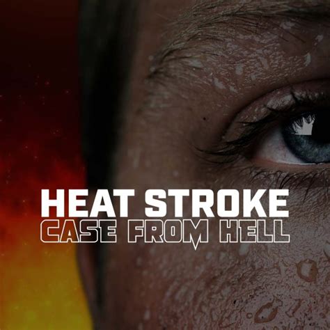 Heat Stroke The Case From Hell University Of Vermont Health Network