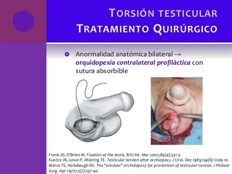 Torsion Testicular