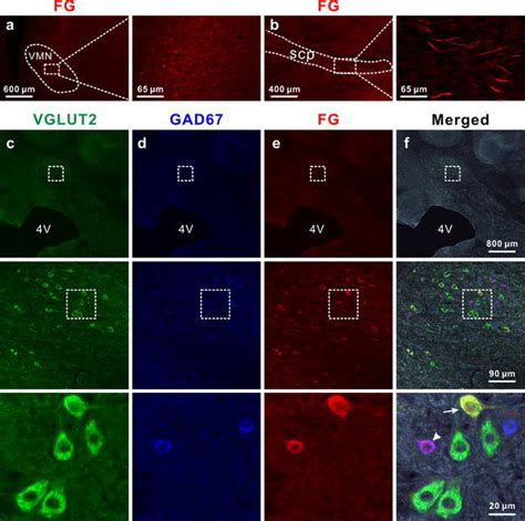 GABAergic and glutamatergic projection neurons in the cerebellar MN ...