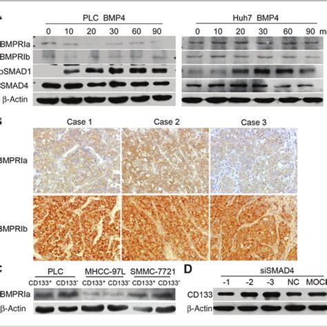 The Expression And Activation Of BMP Receptors In HCC Cell Lines And