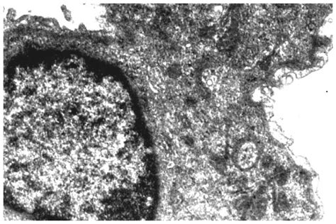 Ultrastructural Changes During Lung Carcinogenesis Modulation By