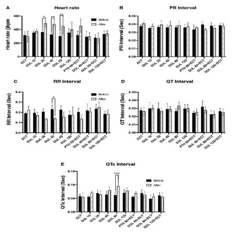 Effects Of Duloxetine Phenytoin And Ecs On Heart Rate And Ecg Indices