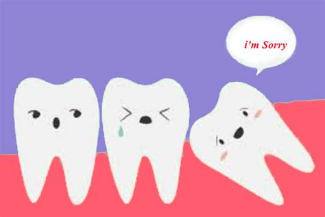 Wisdom Teeth Pain Relief After & Before Removal