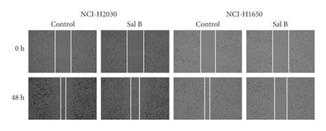 Sal B Suppresses Migration And Invasion Of Nsclc Cells A B Cell