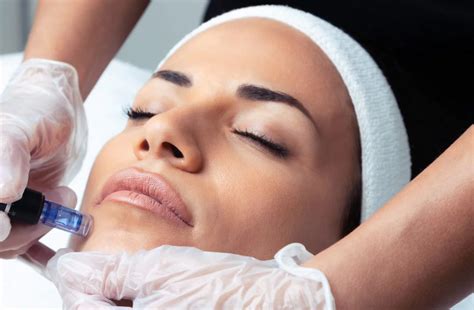 What Is Microneedling Benefits Side Effects Cost Results — Clarion Aesthetics