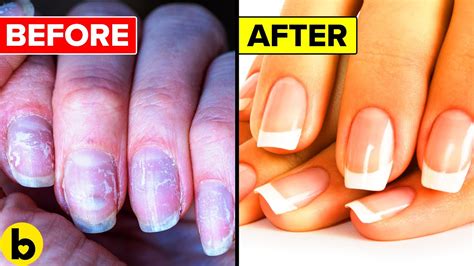 10 Tips To Make Your Nails Grow STRONGER And Longer FAST YouTube