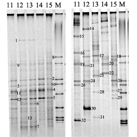 Dgge Gels Showing Diversity Of 16s Rrna Gene Fragments Ampli Fi Ed From Download Scientific