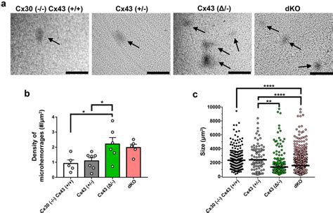 High Pressure Induced Brain Leakage In Cx43 Transgenic Mice A