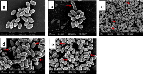 Scanning electron microscopic morphology of: a = untreated E. coli ...