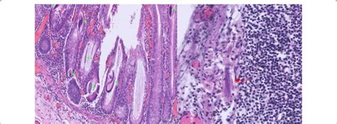 Shows Green Arrowhead Indicating Strongyloids In Bowel Lumen And Red Download Scientific