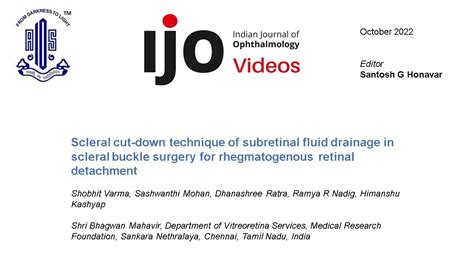 Scleral Cutdown Technique Of Subretinal Fluid Drainage In Scleral Buc