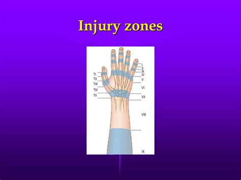 Extensor tendons injury repair and rehabilitation | PPTX