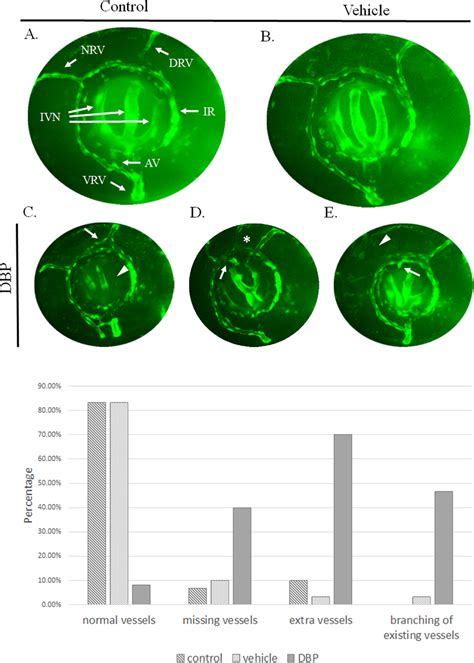 Dbp Induces Changes In The Vascular Pattern Of The Eye Tg Fli Egfp