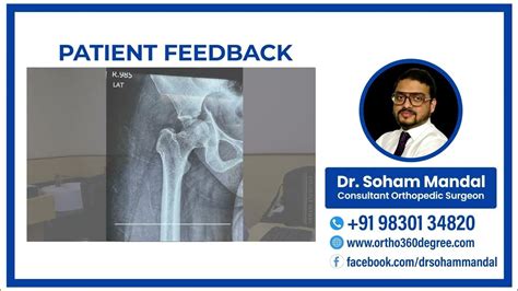 Patient Success Story Dr Soham Mondal Orthopedic Doctor Best