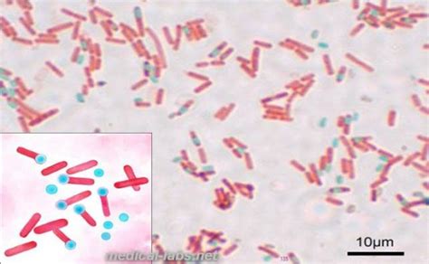 Malachite green stain | Medical Laboratories