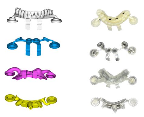 IMPLANT SURGICAL GUIDE AND PLANNING – Ekram Center