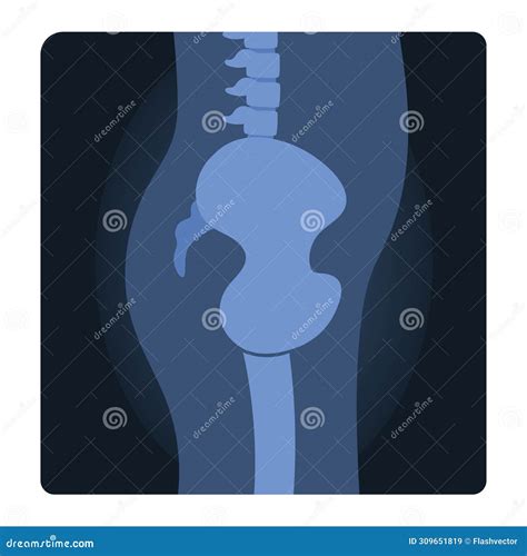 Xray Shot Of Human Body Stock Vector Illustration Of Spine 309651819