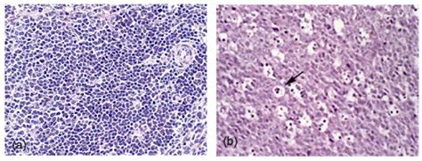 Representative Sections Of Splenic White Pulp Of Wistar Rats After