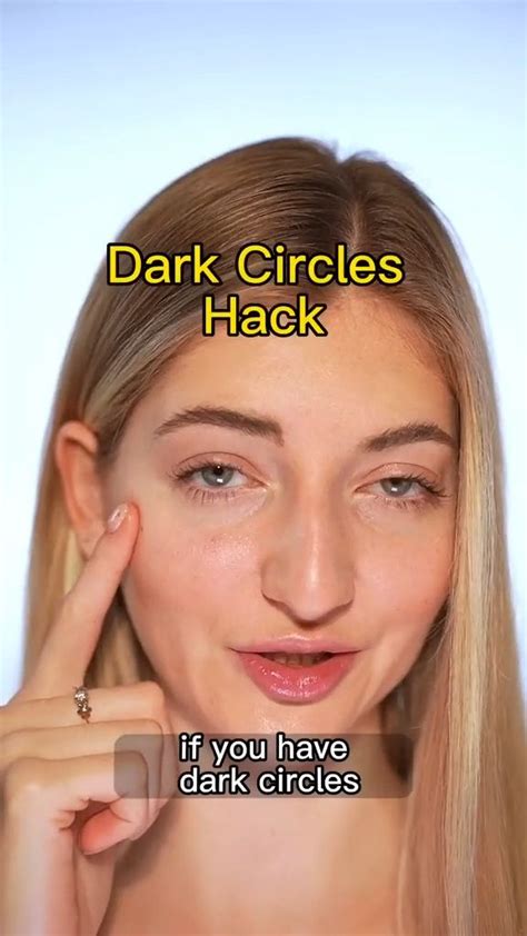 Determine What Kind Of Circles You Have Eye Massage For Dark Circles Dark Circles In 2024